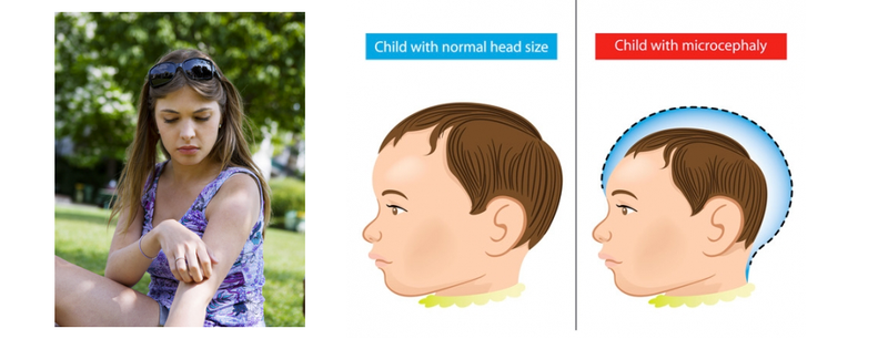 Part of an advertisement hosted on Natural News for a “natural” bug spray to combat Zika virus (Image: Natural News)